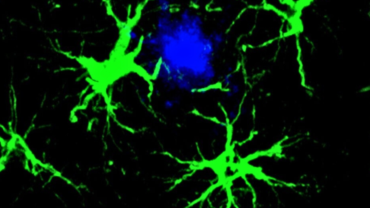 Scientists Cut Amyloid Plaques by 50% in Mice With Engineered Cells