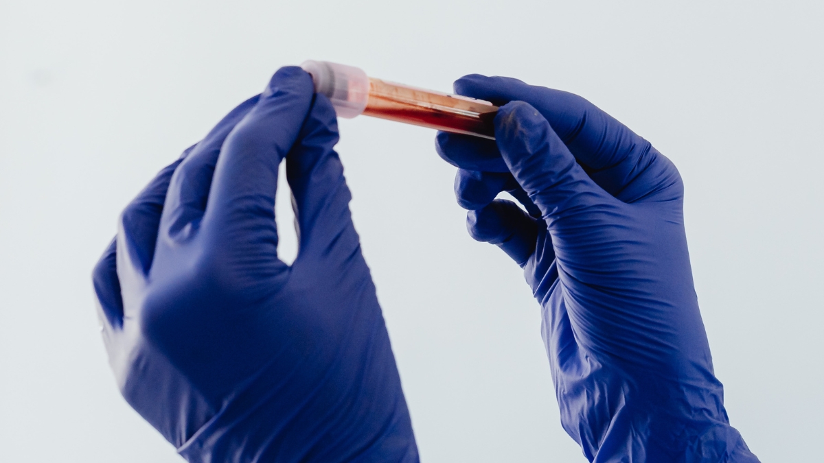 Ženy ve vesmíru by mohly čelit zvýšenému riziku krevních sraženin