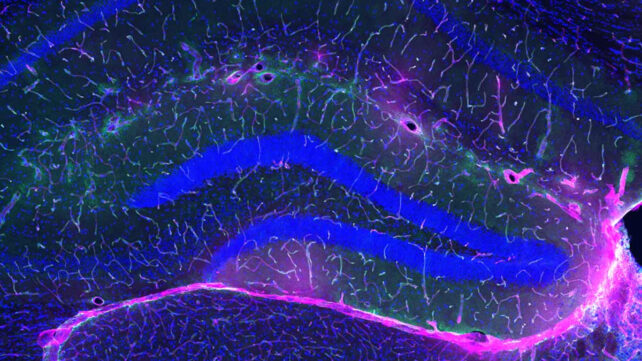 Blood-brain barrier in mice
