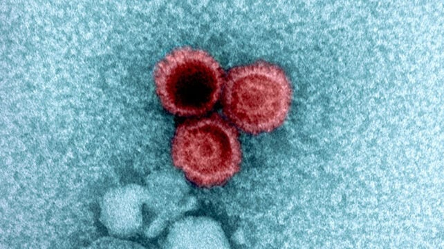 Epstein-Barr virus