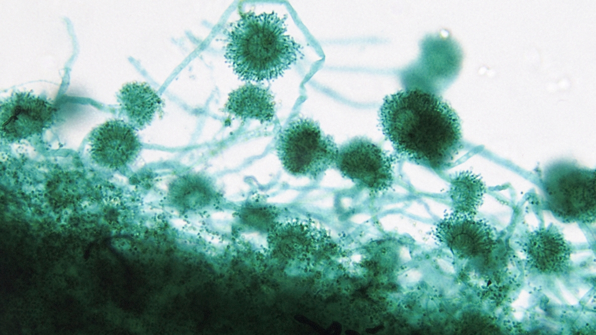 Aspergillus: What We Know About The Fungus Behind Hospital Deaths