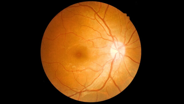 A retina with blood vessels