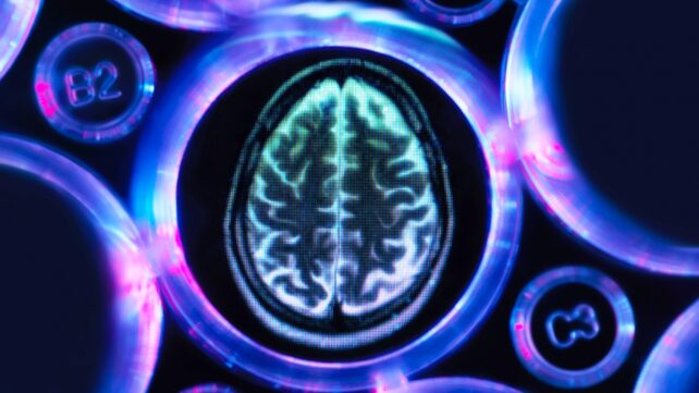 brain in dish illustration