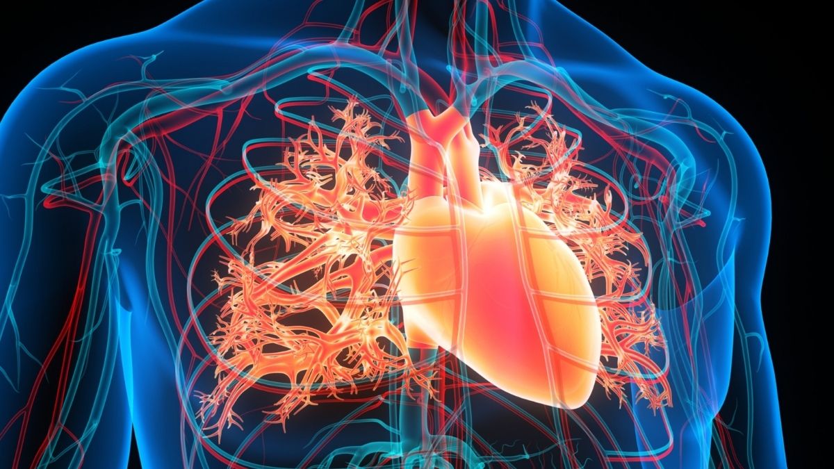 Millions of people have a heart rhythm disorder called atrial fibrillation, which causes the heart's upper chambers or atria to beat chaotically rather than in a smooth, coordinated rhythm.