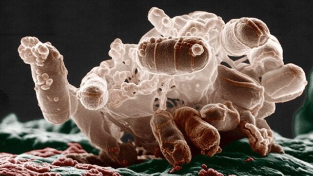 A brownish cluster of E. coli bacteria, seen under a microscope