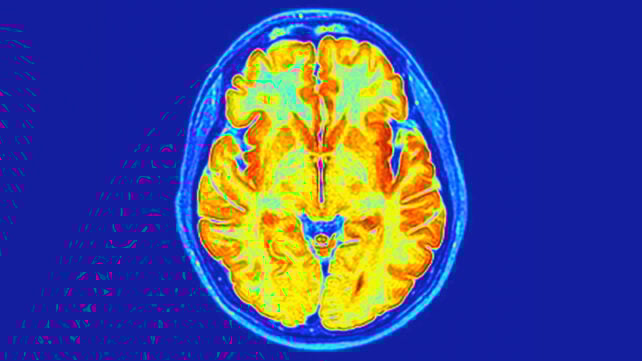 Axial MRI section of a human brain