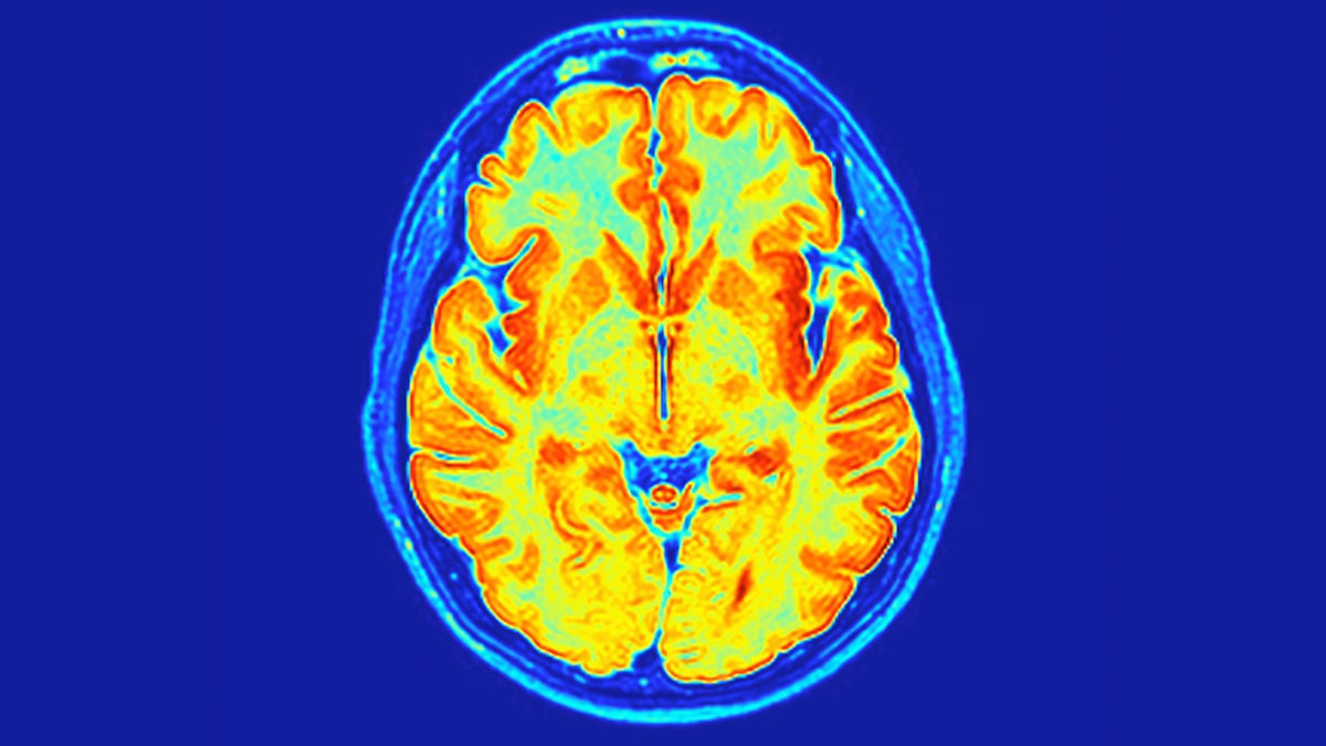 Scientists Have Found a New Neurodevelopmental Disorder Hidden in Our Genes