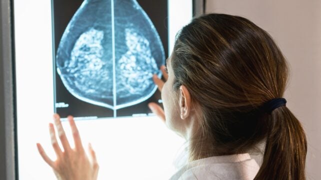 Clinician reviewing a mammogram scan as part of breast cancer screening