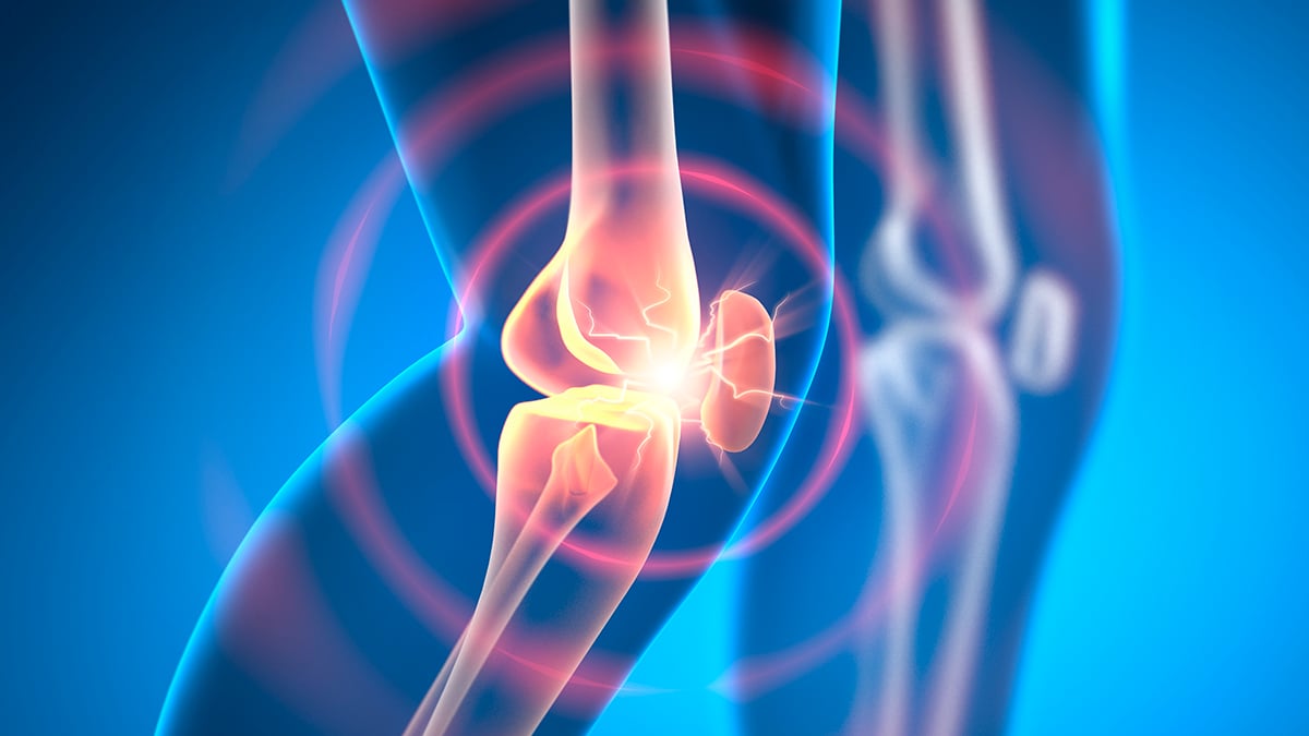 Experimental Drug Can Reverse Osteoarthritis in Weeks, Animal Research Shows