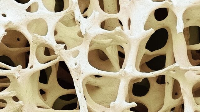 Close view of human bone tissue seen under scanning electron microscope