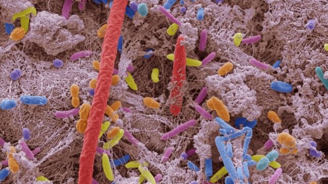 Scanning microscope image of oral bacteria.