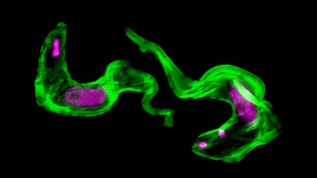 Sleeping sickness parasite