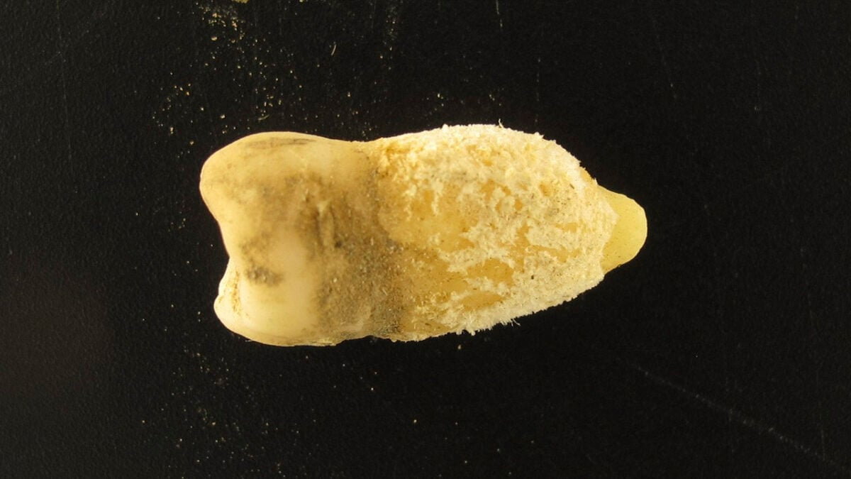 Este dente pertenceu a um jovem que viveu no Altiplano boliviano há cerca de 700 anos. Os pesquisadores detectaram nele a bactéria da escarlatina, Streptococcus pyogenes. (Eurac Research/Guido Valverde)