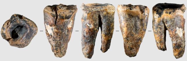 Neanderthals Were Already Drilling Tooth Cavities 60,000 Years Ago
