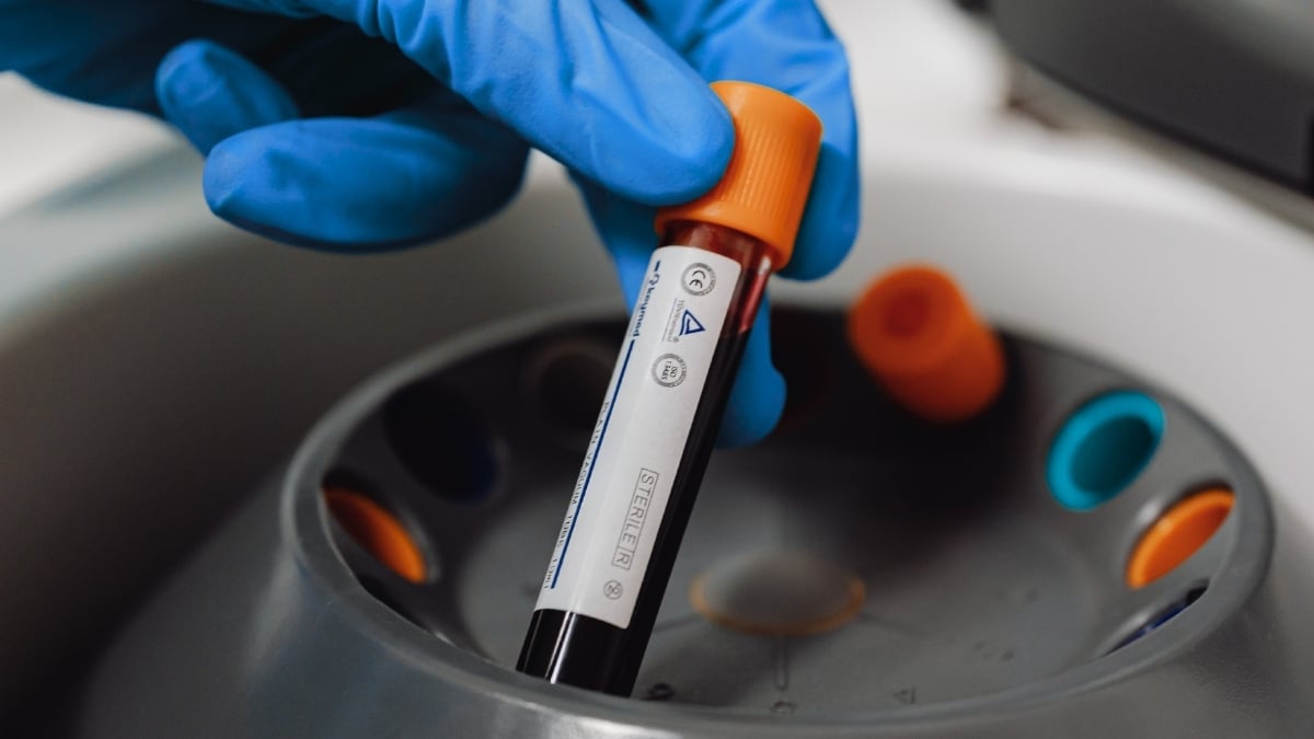 'Forever Chemicals' Found in 98.8% of Human Blood Samples Tested