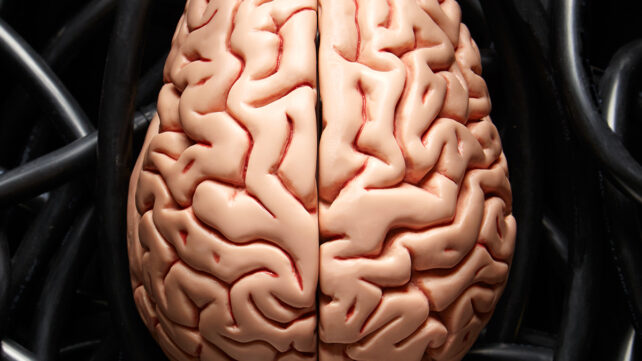 Overheard brain picture