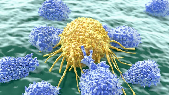Cancer cell being attacked