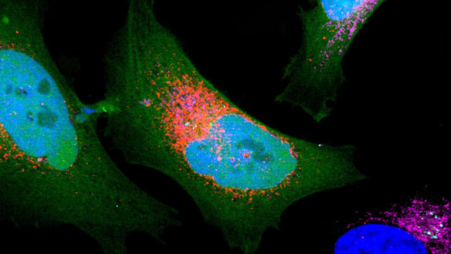 Cancer cell graphic