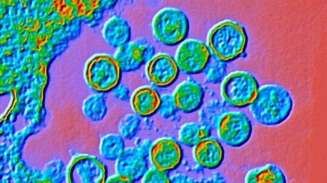 Investigations Begin After Suspected Outbreak of Rare Hantavirus Kills 3 People