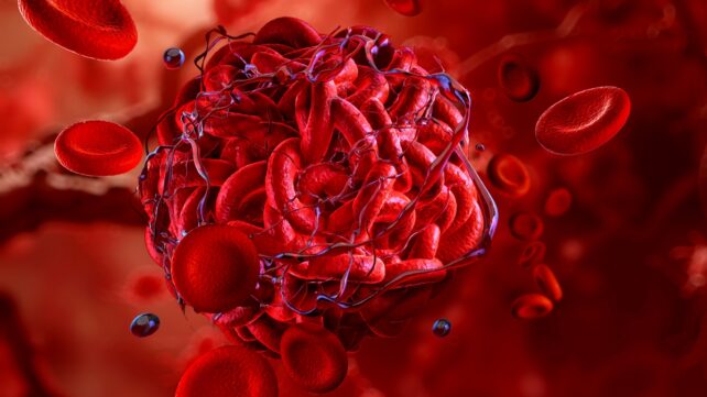 blood clot illustration