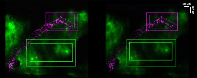 Movement Triggers a Hidden 'Brain Cleaning' Mechanism, Study Shows