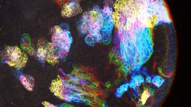 A Strange Pattern Could Explain The Mysterious Origins of Brain Cancer