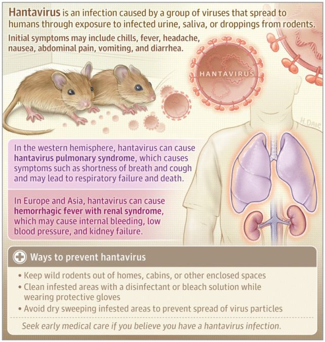 An infographic showing how hantavirus can be transmitted and prevented