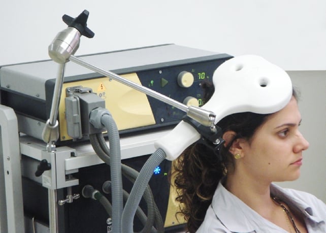 magnetic brain stimulation