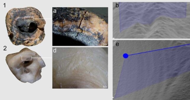 Neanderthals Were Already Drilling Tooth Cavities 60,000 Years Ago