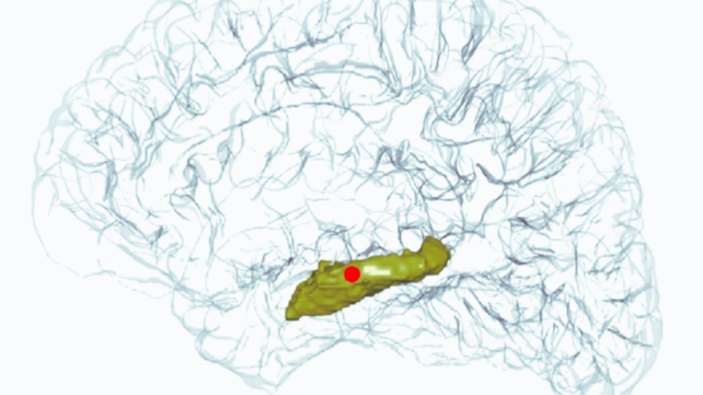 Startling Brain Activity Under Anesthesia Challenges Our Understanding of Consciousness