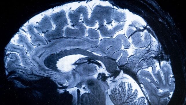 Experimental Brain 'Pacemakers' May Rewire Circuits Linked to Depression