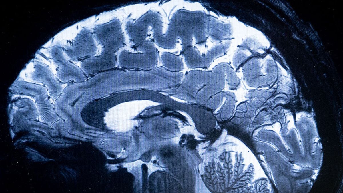 Every year, more than 2 million people in the United States are diagnosed with treatment-resistant depression.