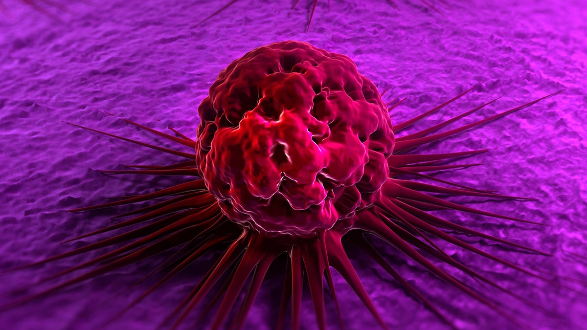 Low Testosterone Is Linked to a Higher Risk of Cancer, Study Finds