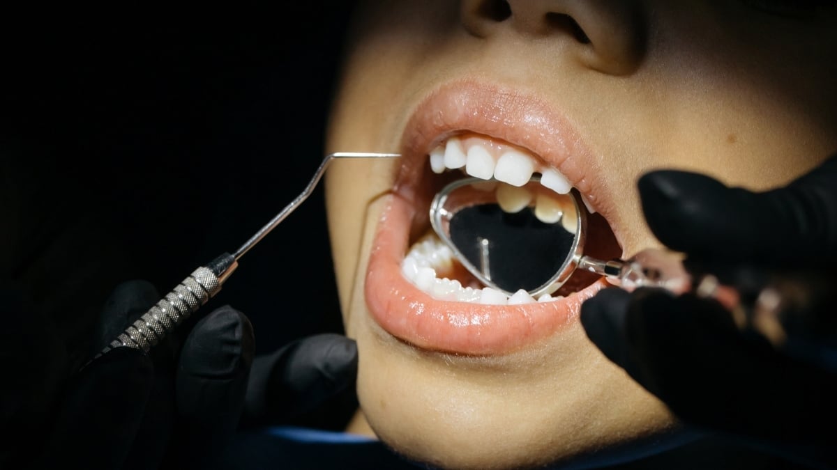 A Little-Known Tooth Condition May Affect Millions of Children