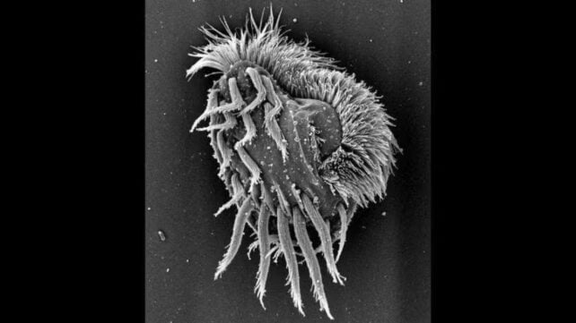 Scanning electron microscope image of a single Euplotes gigatrox cell, showing its rounded body covered with ridges and dense hair-like structures used for movement and feeding.