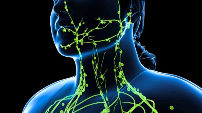 Digital illustration of the lymphatic vessels and nodes in a woman's face, neck, and shoulders, shown as bright green lines over a blue body outline.