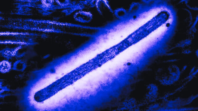 Transmission electron microscope image of a rod-shaped influenza A H5N1/bird flu virion; in the background is a second transmission electron micrograph of H5N1 virus particles (both round and rod-shaped). Creative composition and colorization/effects by NIAID; transmission electron micrograph imagery is courtesy CDC. Scale has been modified/not to scale.