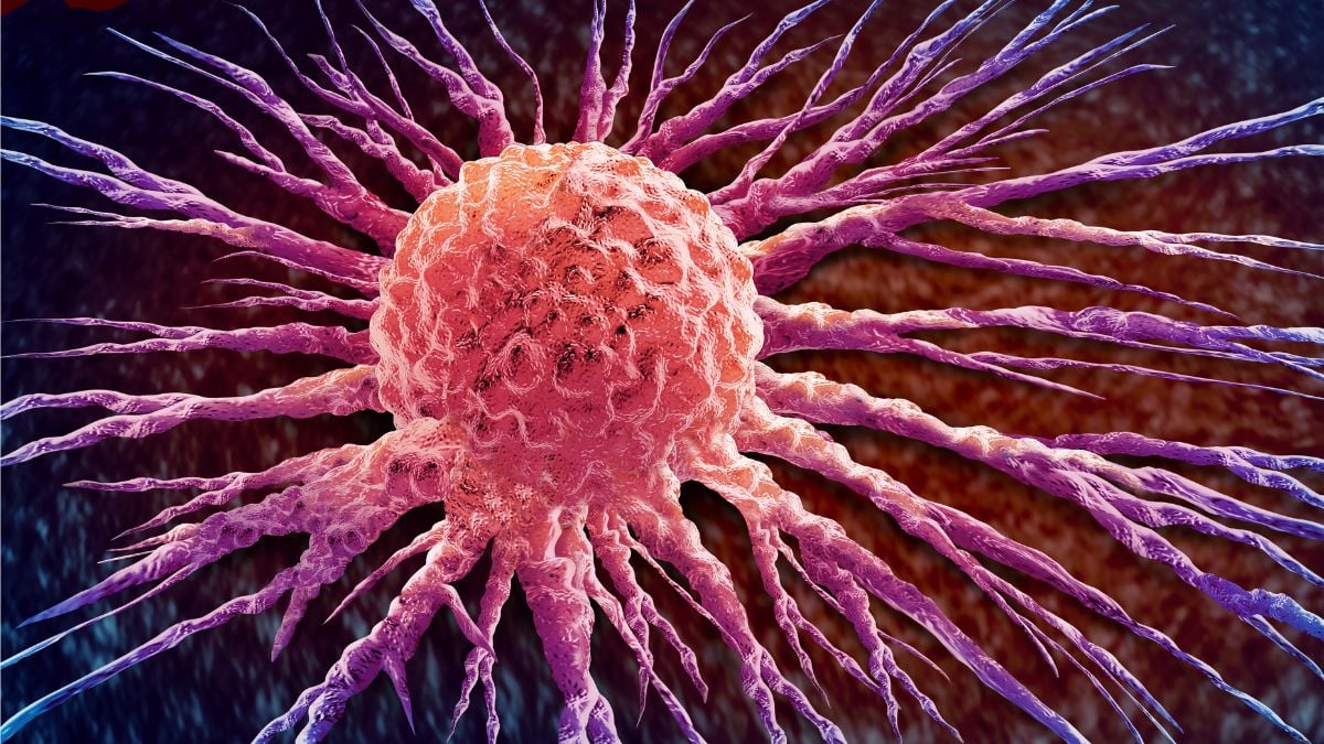 Avance: Píldora casi duplica supervivencia en cáncer de páncreas