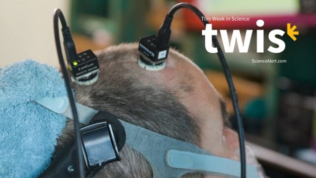 Alt text: Close-up side view of a man’s head with two wired brain-computer interface sensors attached to his scalp, with “This Week in Science” text overlaid.