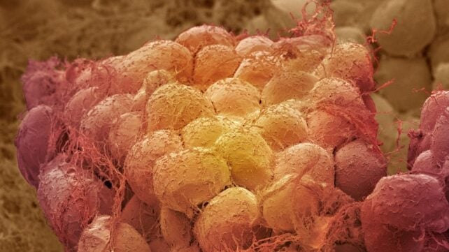 One Diet Helped Aging Mice Lose Fat While Preserving Muscle