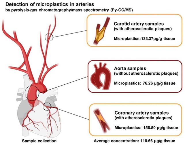 Artery samples