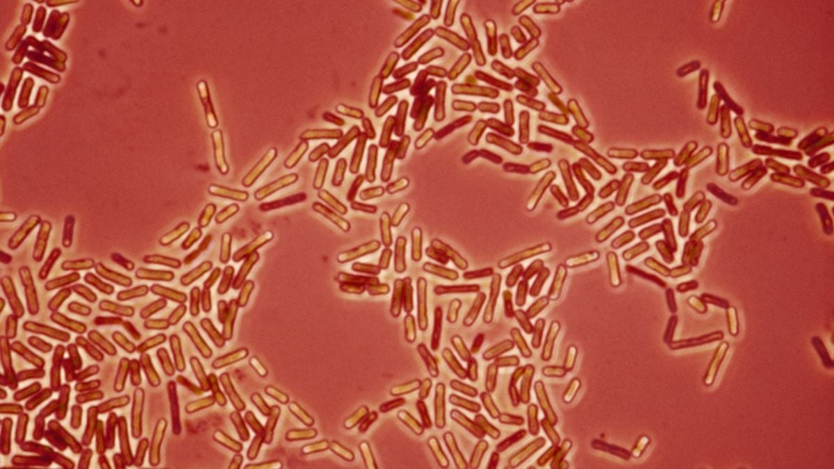 Drug-Resistant Superbugs May Be Jumping Between Pets And Humans, Scientists Warn