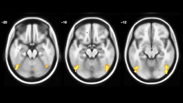 Your Brain Can Rewire Itself to Allow True Multitasking