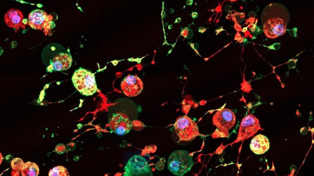 Cell death graphic