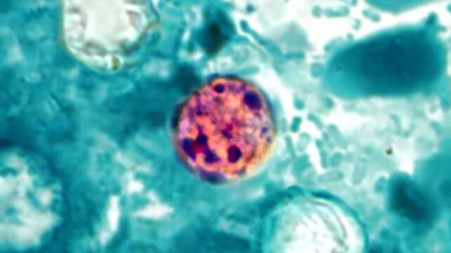 Cyclospora cayetanensis