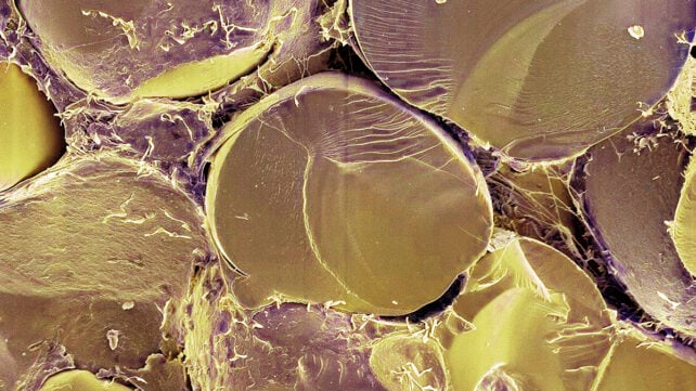 Fat cells