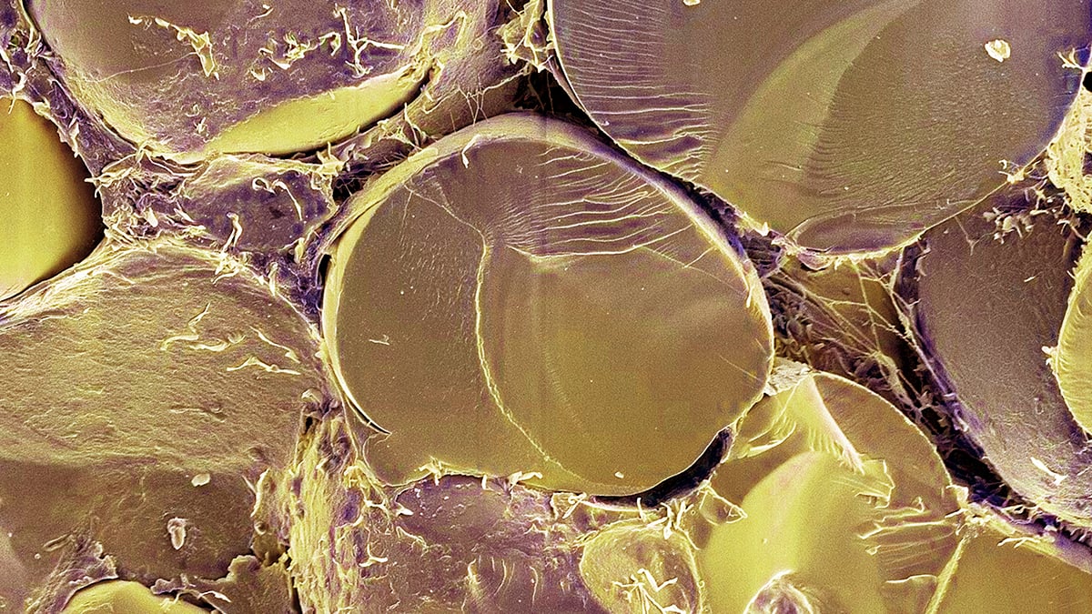 Crucial Fat Metabolism Switch Identified in Human Cells For First Time