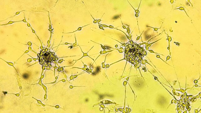 Nanoparticles Cross Blood-Brain Barrier in Mice to Shrink Deadly Glioblastoma