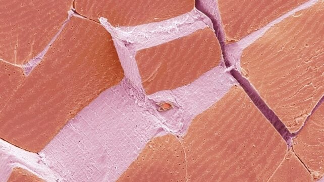 Test Your Eyes: What Is This Week's Microscope Mystery?