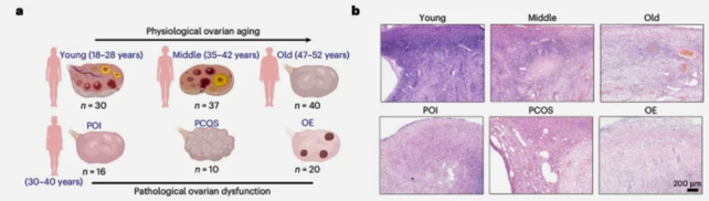 Scientists May Have Found a New Way to Extend Fertility